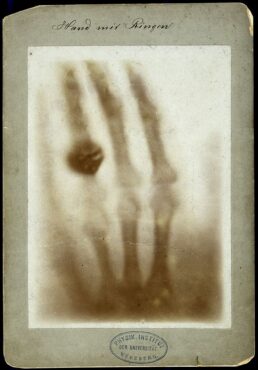 röntgenfoto
